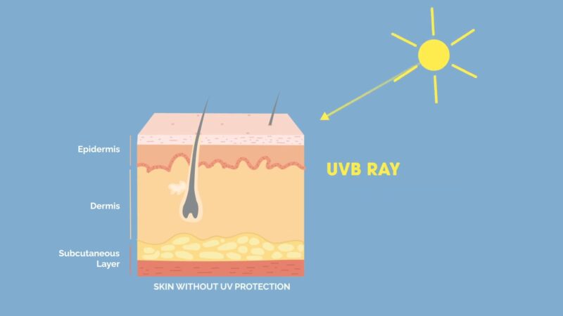How UV Rays Damage the Skin